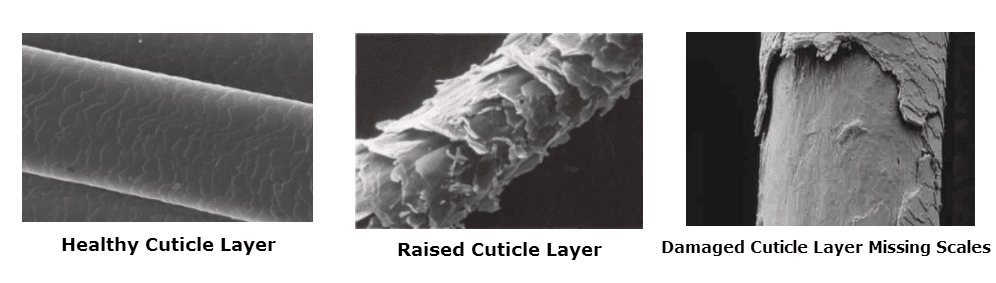 Understanding hair loss and growth