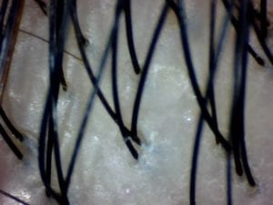 super healthy hair scan