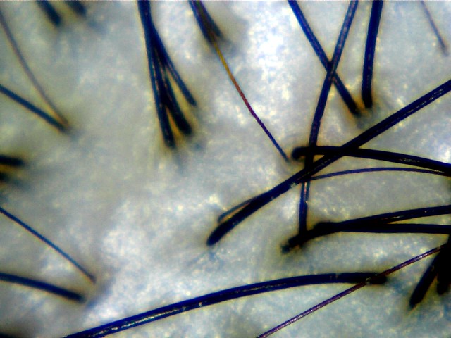 Healthy Scalp