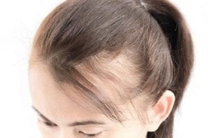 Hairstyle options to hide any signs of thinning