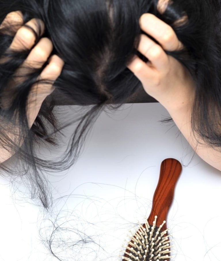 Hair loss, what can you do about it?