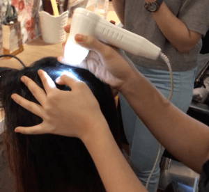 scalp consultation with Bee Choo Ladies