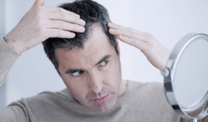 How does a man knows he is suffering from hair loss?
