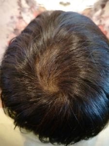 Fourth photo taken (9-Feb-2018)