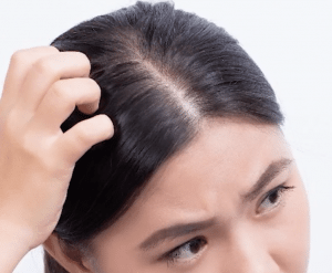Simple ways to tell if you’re having Hair Loss issues.