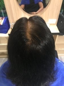 Hair after 3 months of Bee Choo treatment