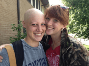 Living with alopecia areata