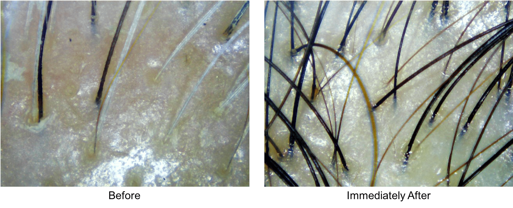 Hair scan before and after the natural dye — black hair unchanged, white hair turned copperish