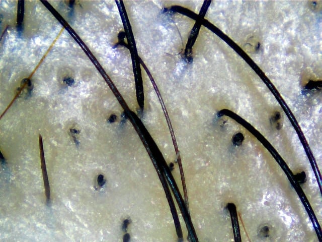 Hair scan showing broken hairs