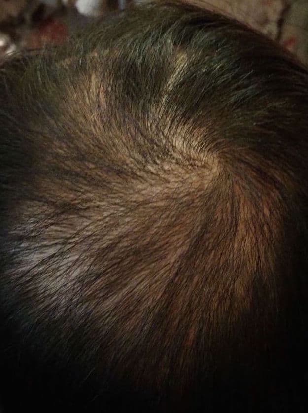 2 Months Later