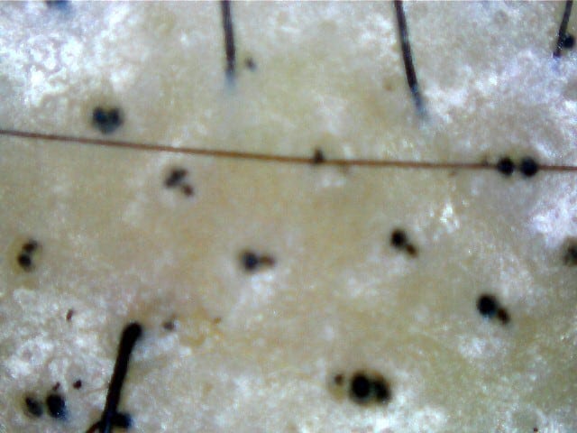 Treatments for Bacterial Infection and more