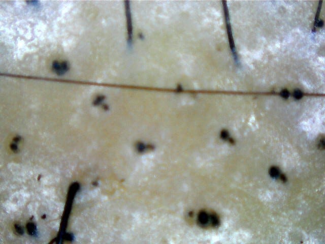Treatments for Bacterial Infection and more