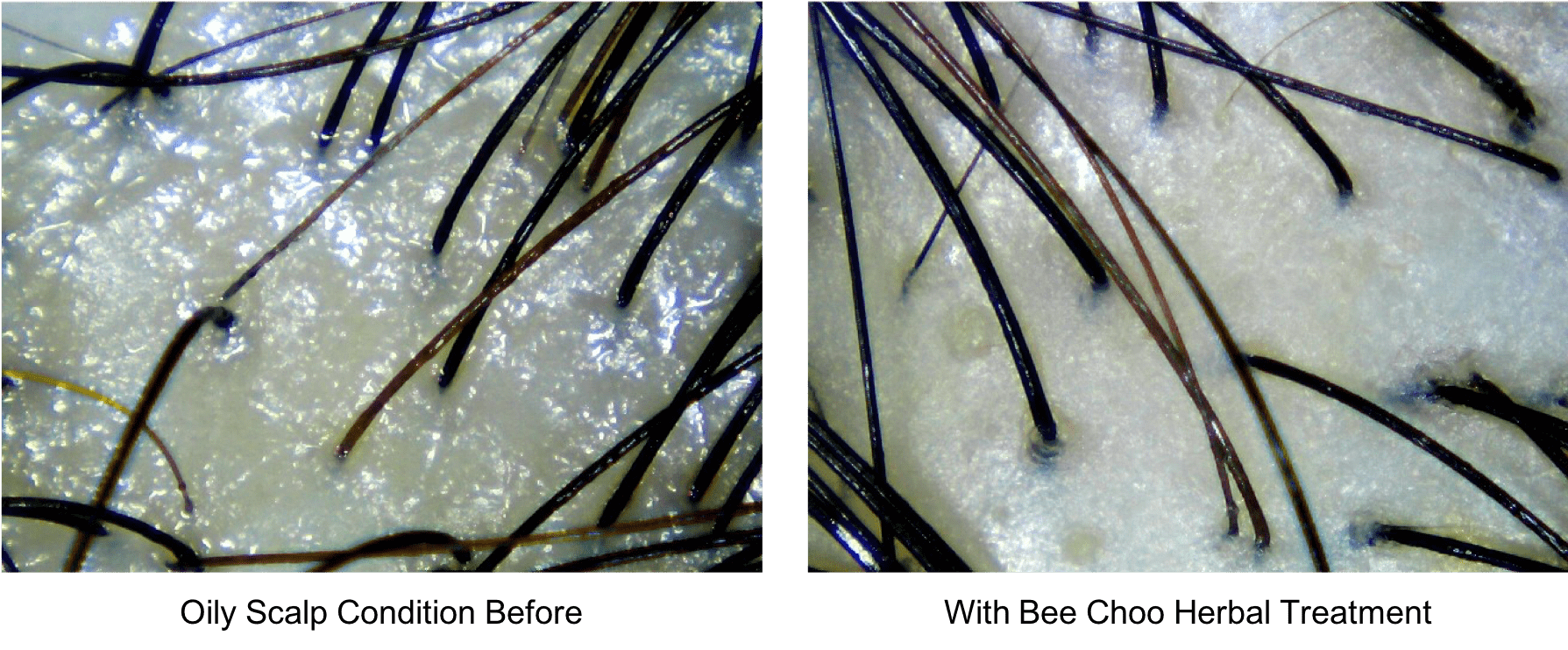 oily scalp before and after hair scan
