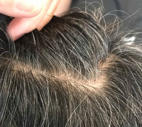 White hair treatment — hand parting hair showing grey and white roots